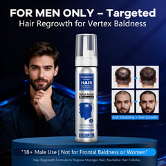 CARENICE Minoxidil Foam bottle label highlights 5% concentration and biotin boost.