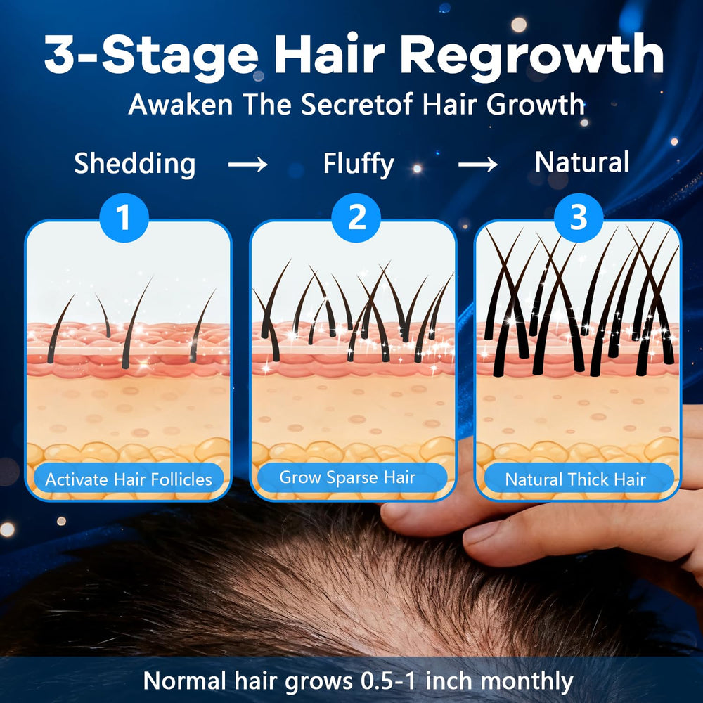 CARENICE Visible hair growth with Minoxidil Foam when used regularly.