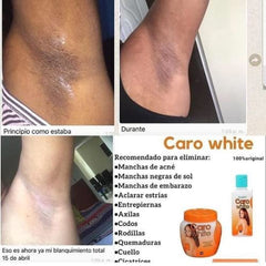 Caro White Set-3 lotion bottle pump demonstrates quick moisture delivery for all skin types.