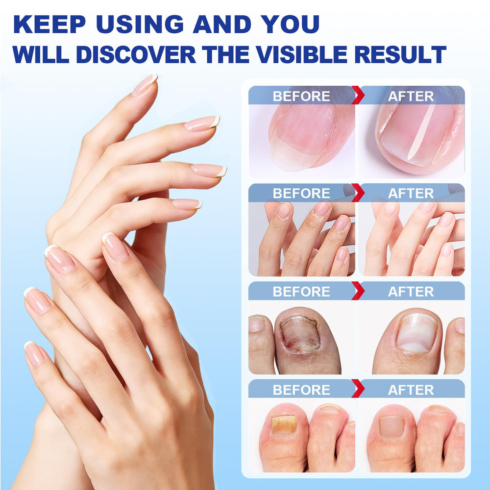 CauseYouLove nail patches showing 8-hour renewal for improved nail appearance.