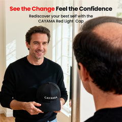 CAYAMA Red Light Hair Growth Cap with frontal focus targets thinning hairline areas.