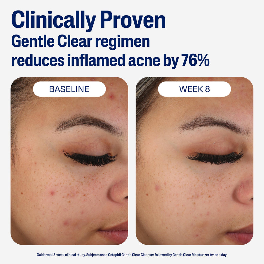 Cetaphil dermatologist-tested moisturizer suitable for sensitive skin