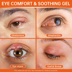CHANGARLOAD gel with calendula promotes gentle eyelid care.