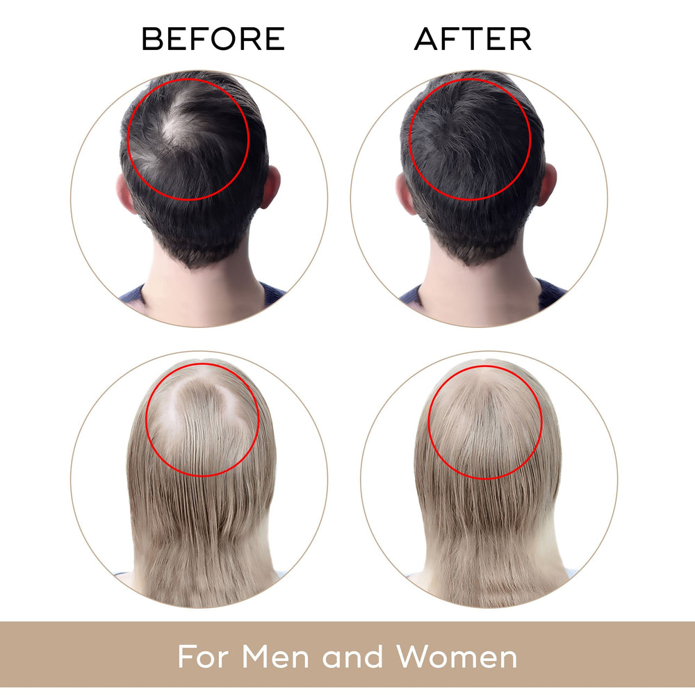 Charismo Dekohair serum scalp-application shot emphasizing easy massage and absorption