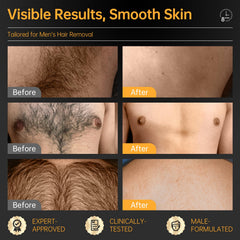 CKM Hair Removal Cream for Men on back hair with an ultra-clean finish.