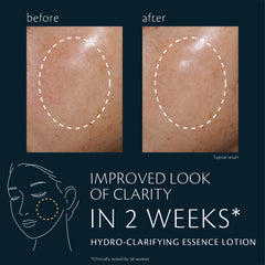Clé de Peau Beauté Hydro-Clarifying Essence Lotion on hand shows silky texture for daily use