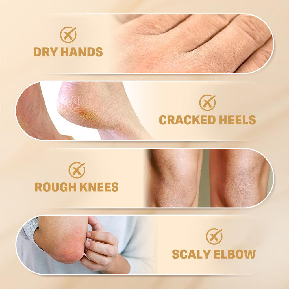 Clyecfra winter dry-skin setup emphasizes protection in cold environments.