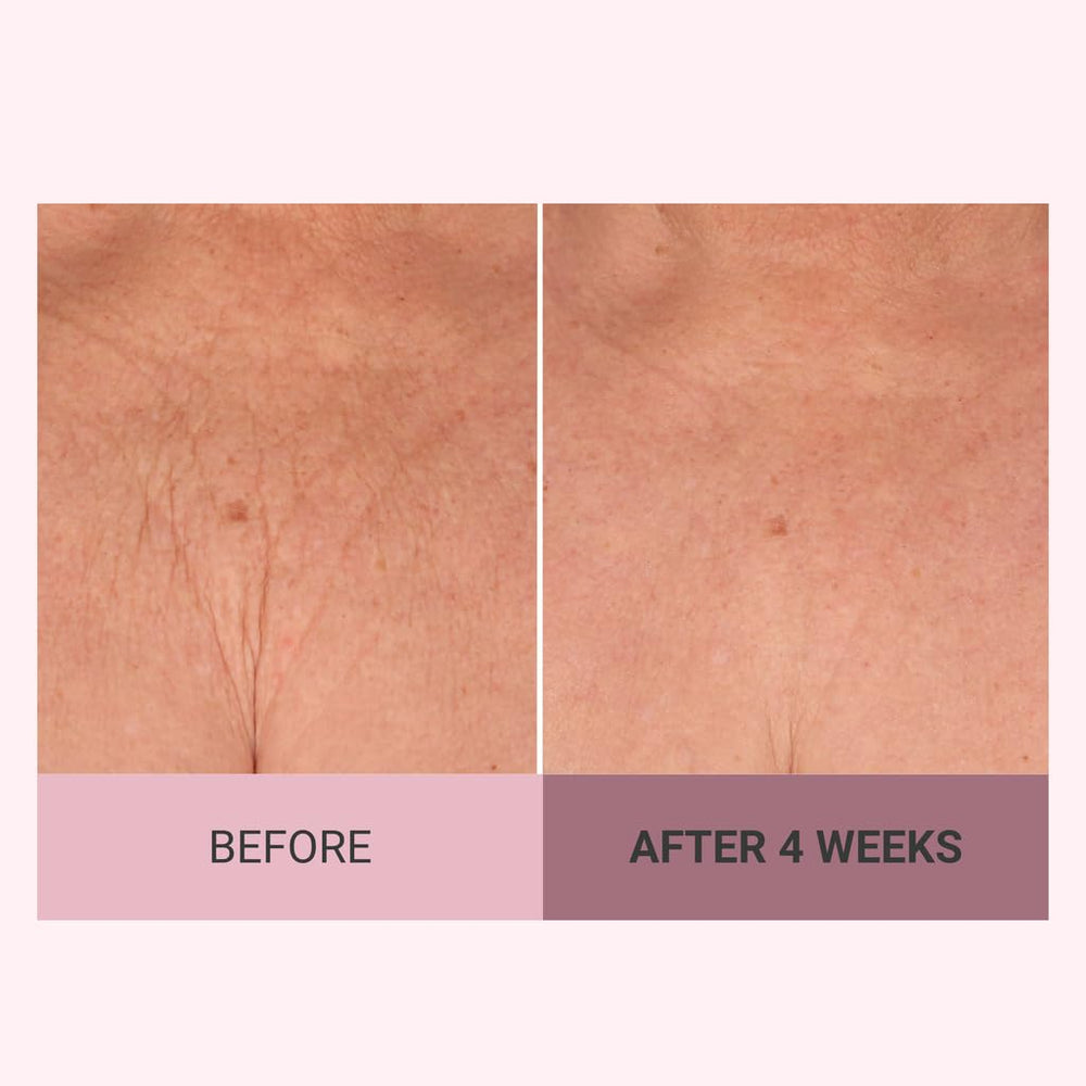 Consult Beaute Champagne Lift arms application illustrates firming in upper arms.