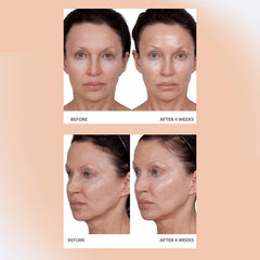Consult Beaute Volumagen cream face application, hydrating smooth application