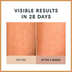 Consult Beaute Unscented Champagne Lift arm area—targets crepey skin.