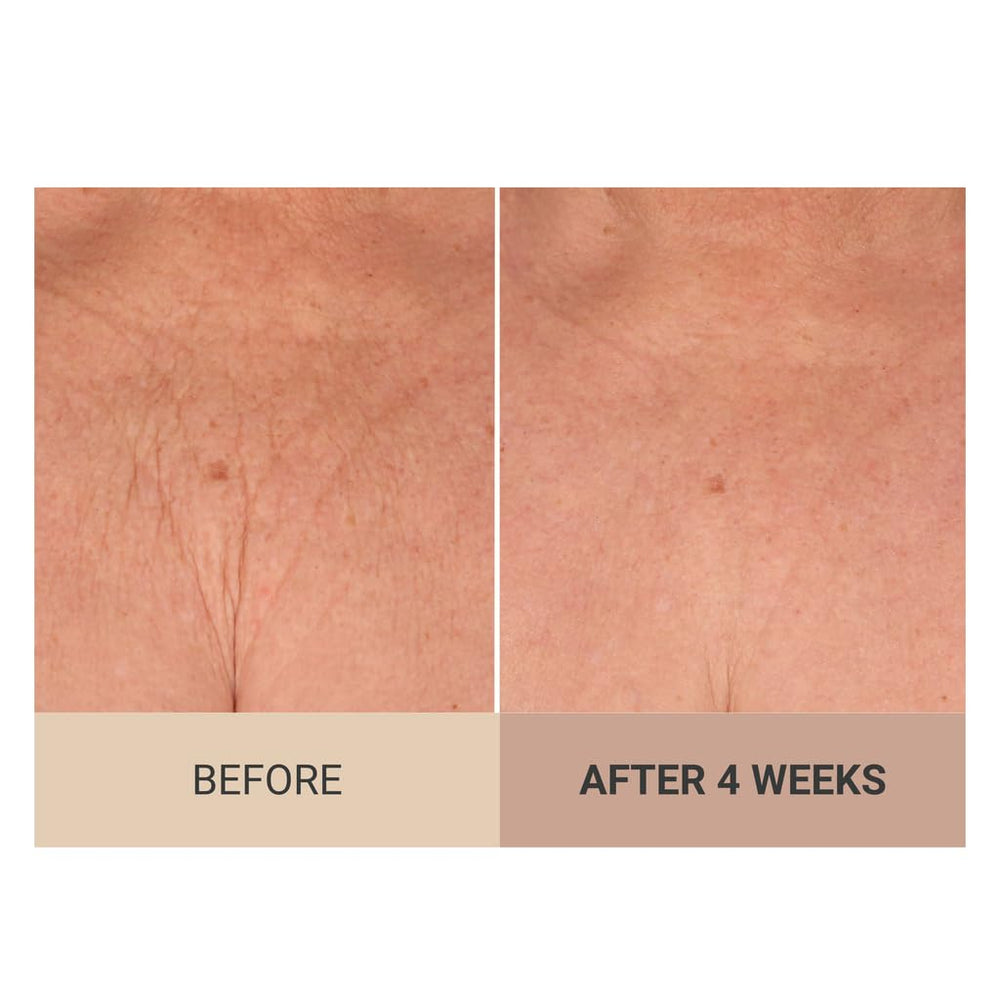 Consult Beaute Unscented Champagne Lift dry skin—deep nourishment.