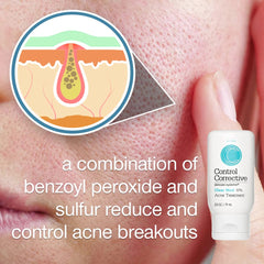 CONTROL CORRECTIVE Clear Med 10% suitable for day or night use on skin.