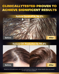 COOLKESI Shampoo and Conditioner set displayed together for versatile care.