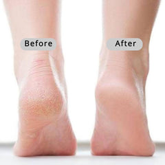 CopesFuda callus remover foot tool for safe maintenance