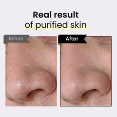 Coxir TXA Black Rice Pore Mask closeup texture shows soft gel for refreshing skin.