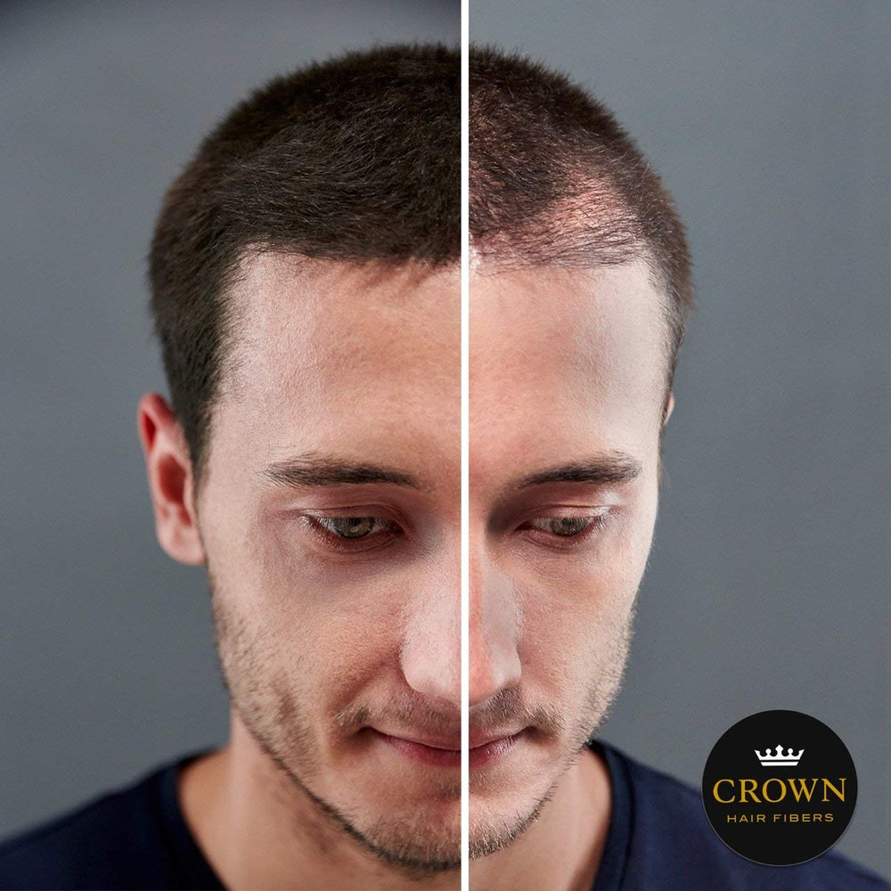 Keratin-based texture of CROWN TWENTY1 fibers shown for natural thickening.