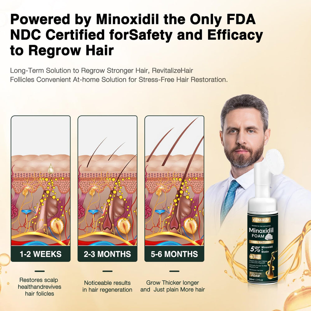 CUNVILEF 5% Minoxidil Foam close-up shows creamy texture aiding scalp care.