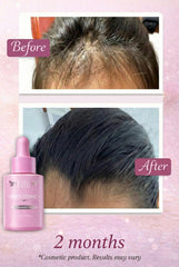 D'Luchi Kaba Tonic dropper enables precise scalp application.