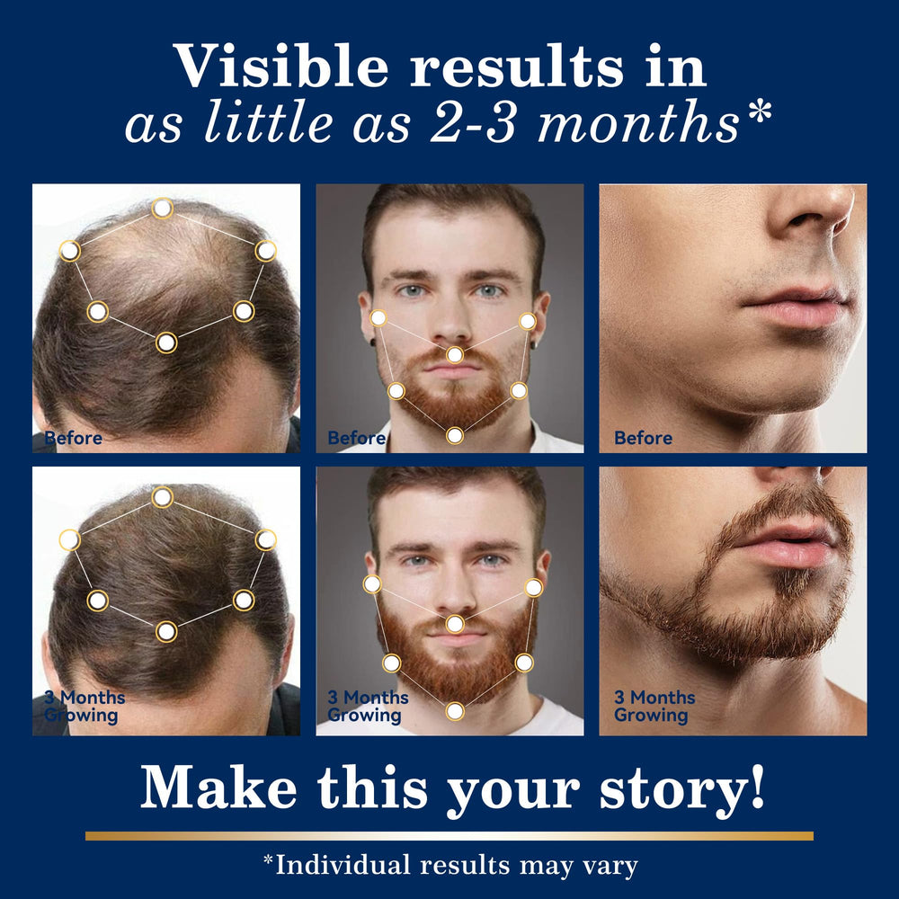 DAAZZS scalp thinning support highlights thinning areas and density appearance.