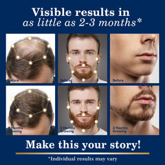DAAZZS scalp thinning support highlights thinning areas and density appearance.