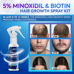 DABIDA Minoxidil 5% bottle side view for easy spray use.