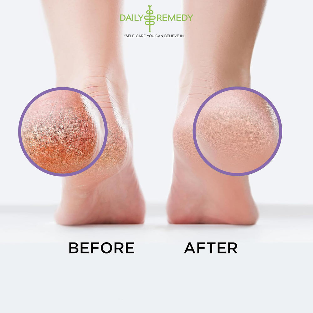 Essential oils from Daily Remedy Calming Lavender Foot Soak, featuring lavender and tea tree scents.
