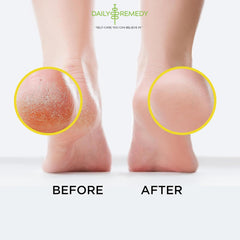 Daily Remedy Citrus Detox Foot Soak salts dissolve to begin a soothing foot bath.