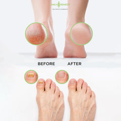 Daily Remedy foot soak with epsom salts and natural herbs
