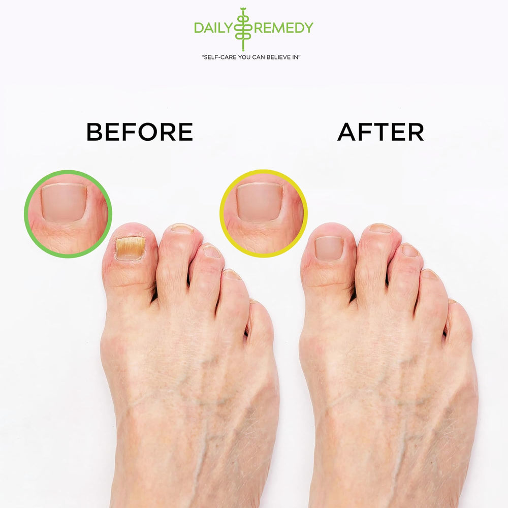 Feet soaking in a basin with Daily Remedy foot soak for at-home spa moment