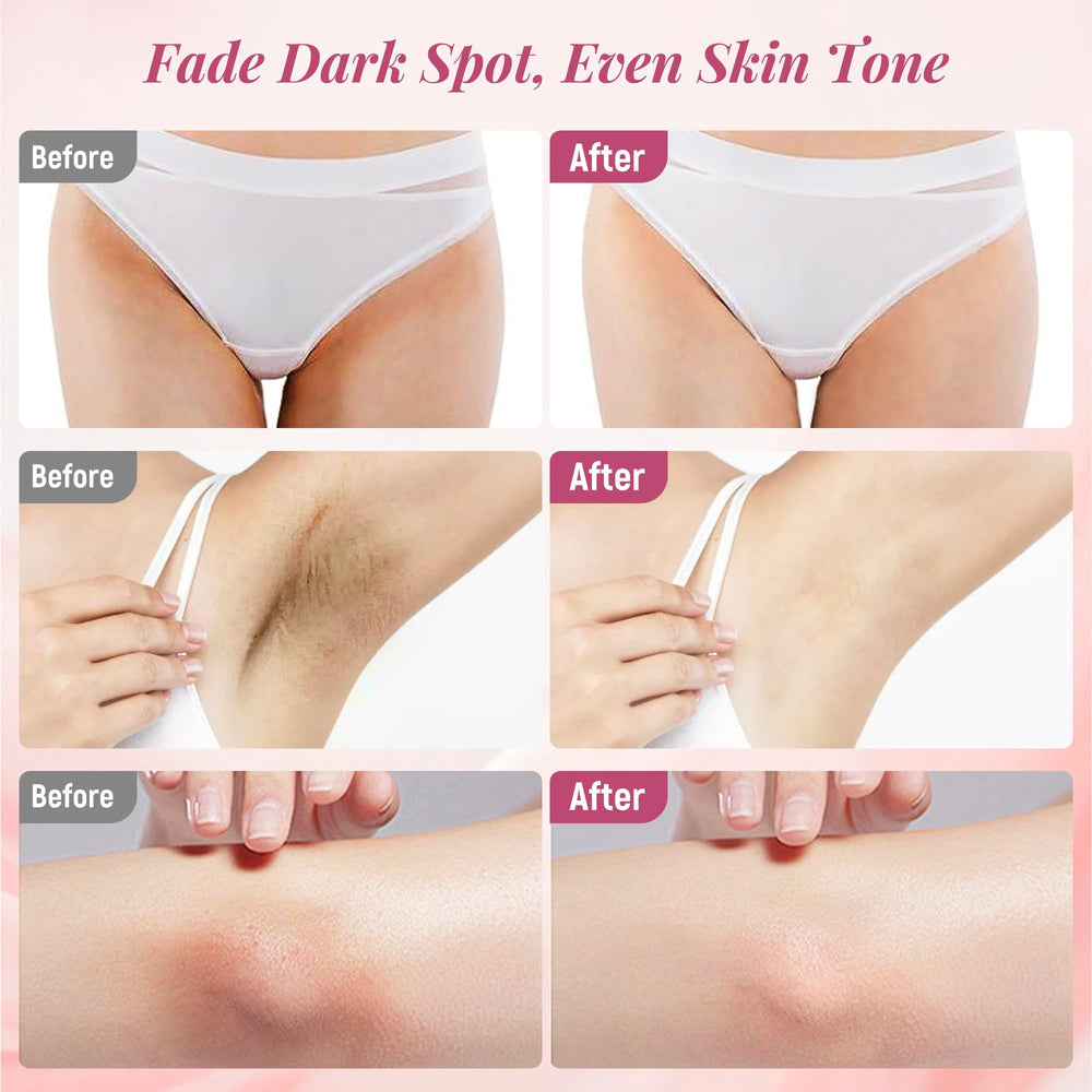 DCSCRK Skin Lightening Cream inner thighs close-up shows even tone