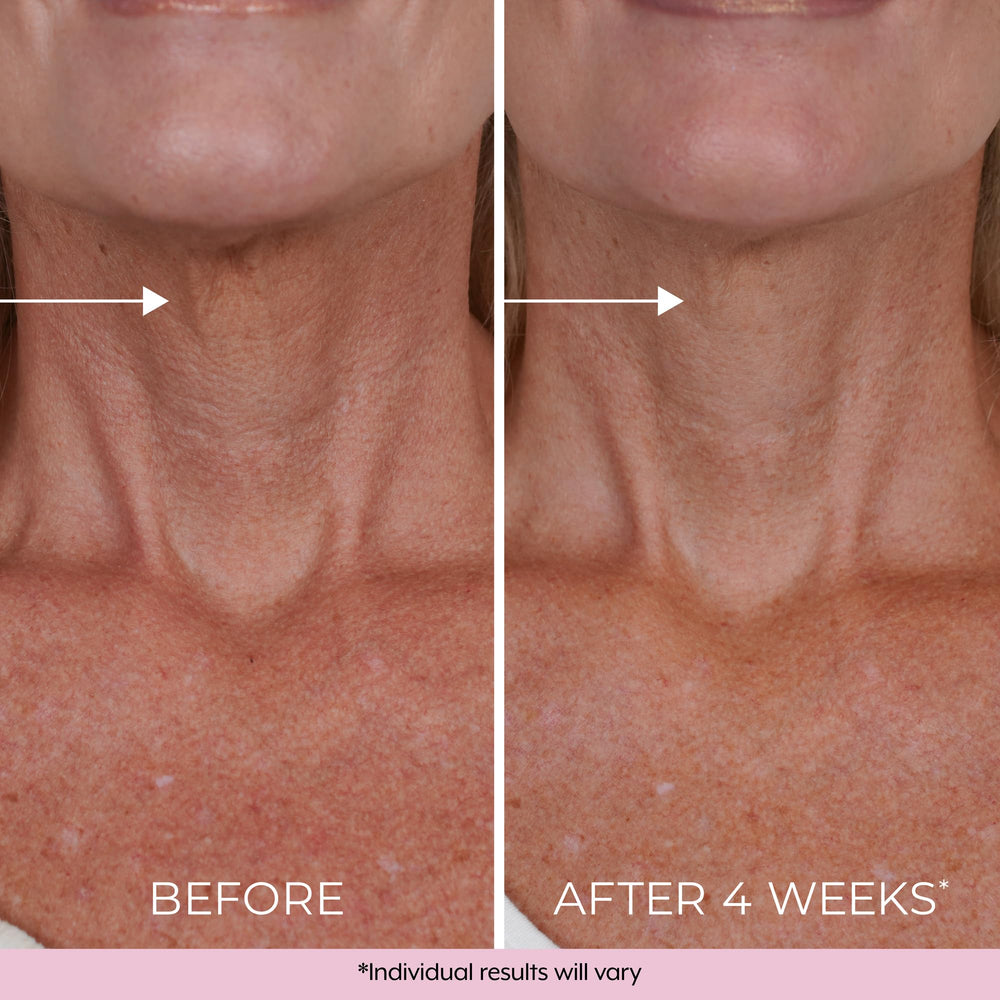 DEKLIDERM dermatologist-tested label on packaging supports suitability for all skin types.