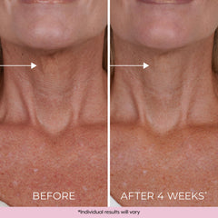 DEKLIDERM dermatologist-tested label on packaging supports suitability for all skin types.