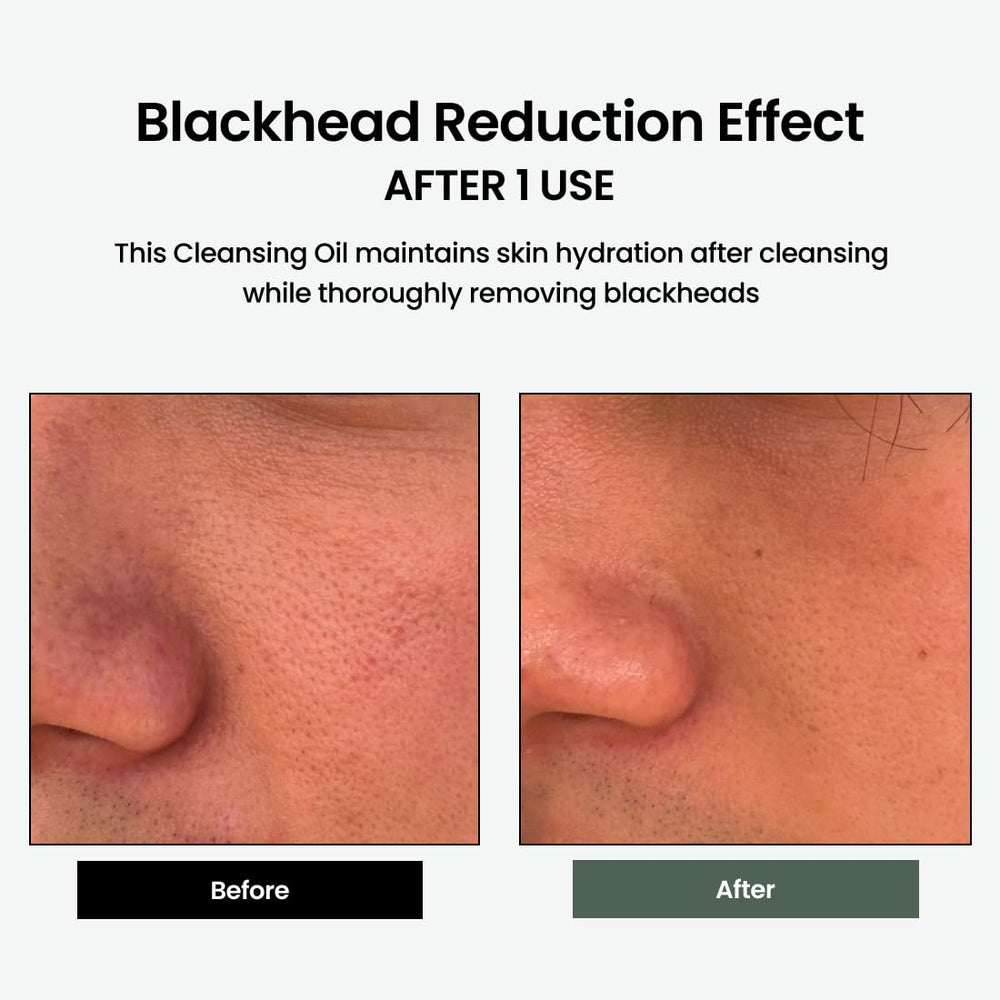 Centella TECA ingredient highlight showing soothing properties for sensitive skin during cleansing.