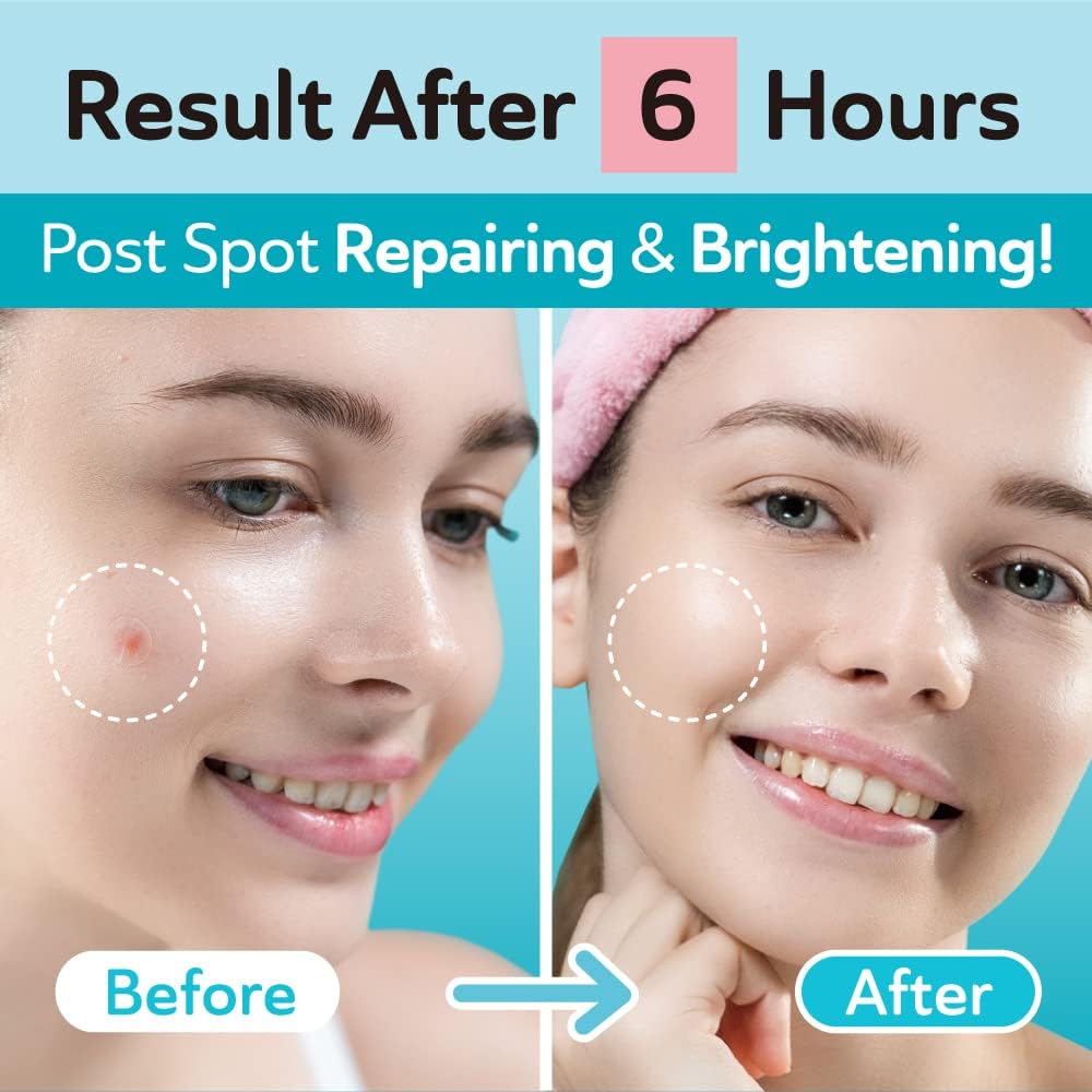 DERMA ANGEL Nighttime 12mm patch enables faster absorption