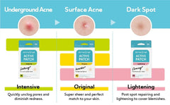 DERMA ANGEL patches protect pimples from touching and irritation.