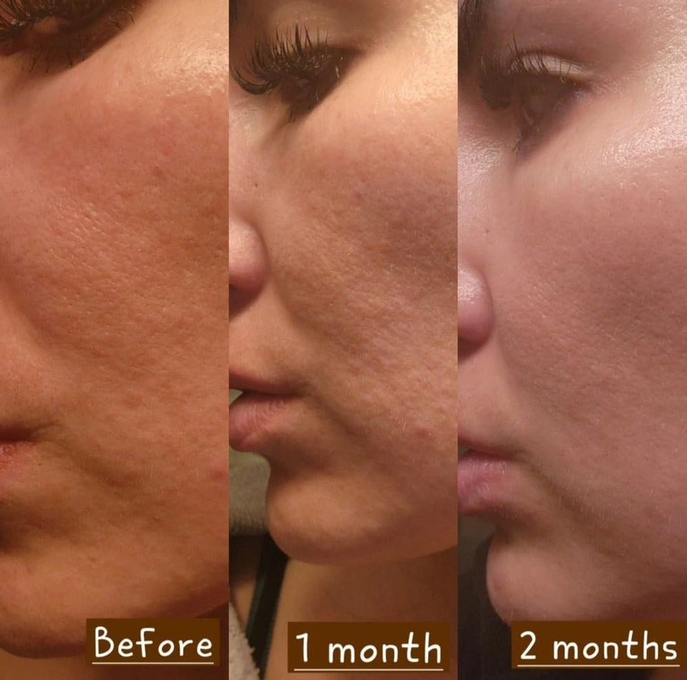 Derma Detox Night Cream Hydration — deep moisture while you sleep.