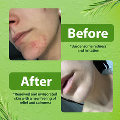 Derma-Nu 2-pack front view—paraben-free and gentle on all skin types