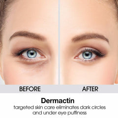 Dermactin charcoal-infused eye cream calms delicate eye skin and impurities.