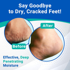 Dermal Therapy Heel Care Cream absorbed quickly leaving a non-greasy finish