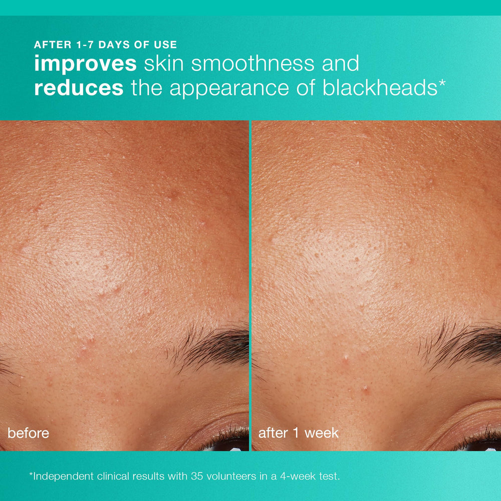 Dermalogica Clear and Brighten Kit step 1 Cleanse demonstrates refreshing cleansing for daily use.