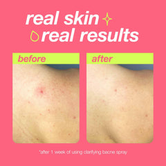 Dermalogica Tea Tree Oil soothes redness and irritation reduction.