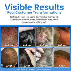 Dermasolve shampoo lather on hair for soothing cleanse