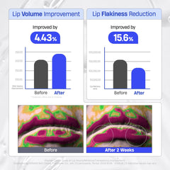 DERMATORY Hyalluron Peptide Volume Lip Mask Balm day and night use for flexible care.