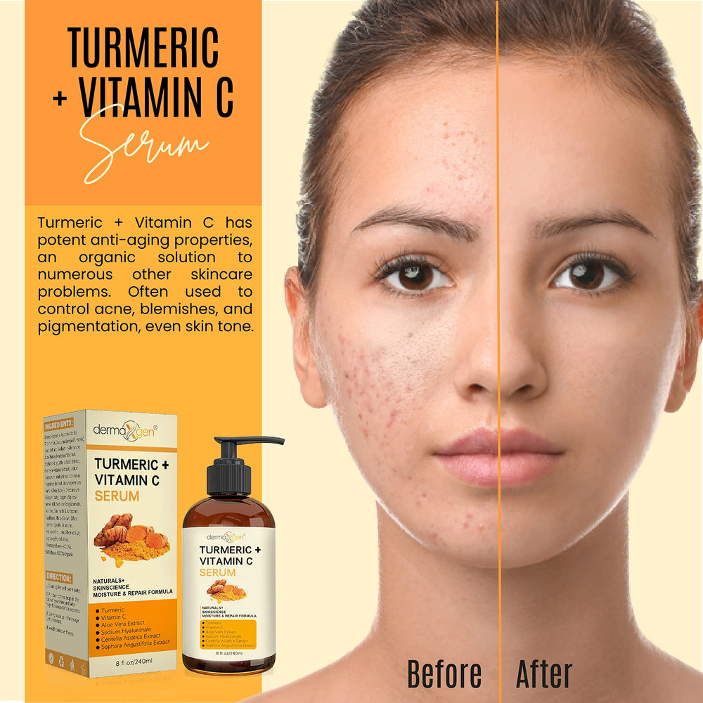 DERMAXGEN turmeric-vitamin-c-blend targets age spots and dullness with antioxidants.