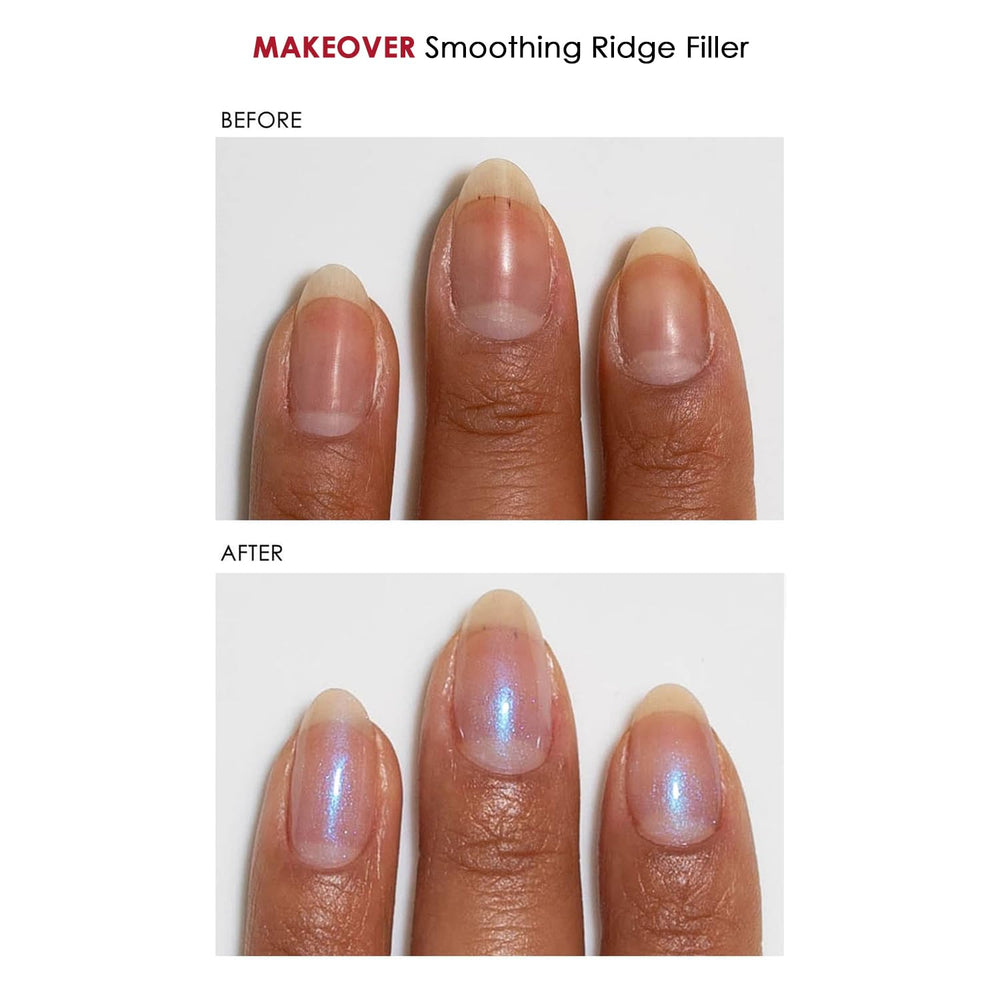 Dermelect Nail Brightener neutralizes yellow tones for a brighter nail.
