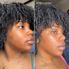 Pack of 3 Dermisa fade cream ready for daily use