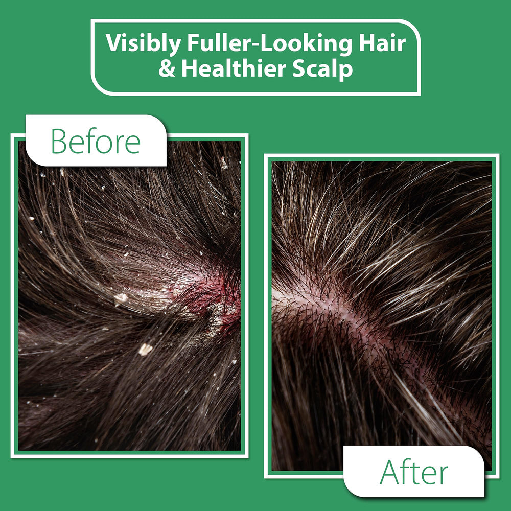 DERMOIA Tea Tree oil close up highlighting calming scalp notes