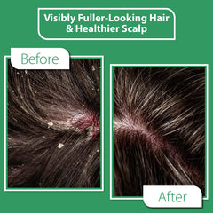 DERMOIA Tea Tree oil close up highlighting calming scalp notes