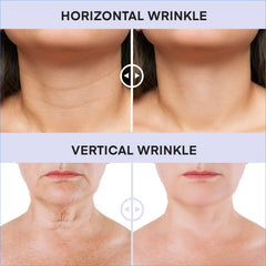 DERPHEA neck cream delivers a subtle lifting sensation on the neck.