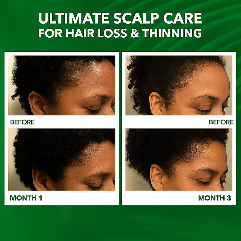 Dersie scalp massage application showing simple daily care for curls